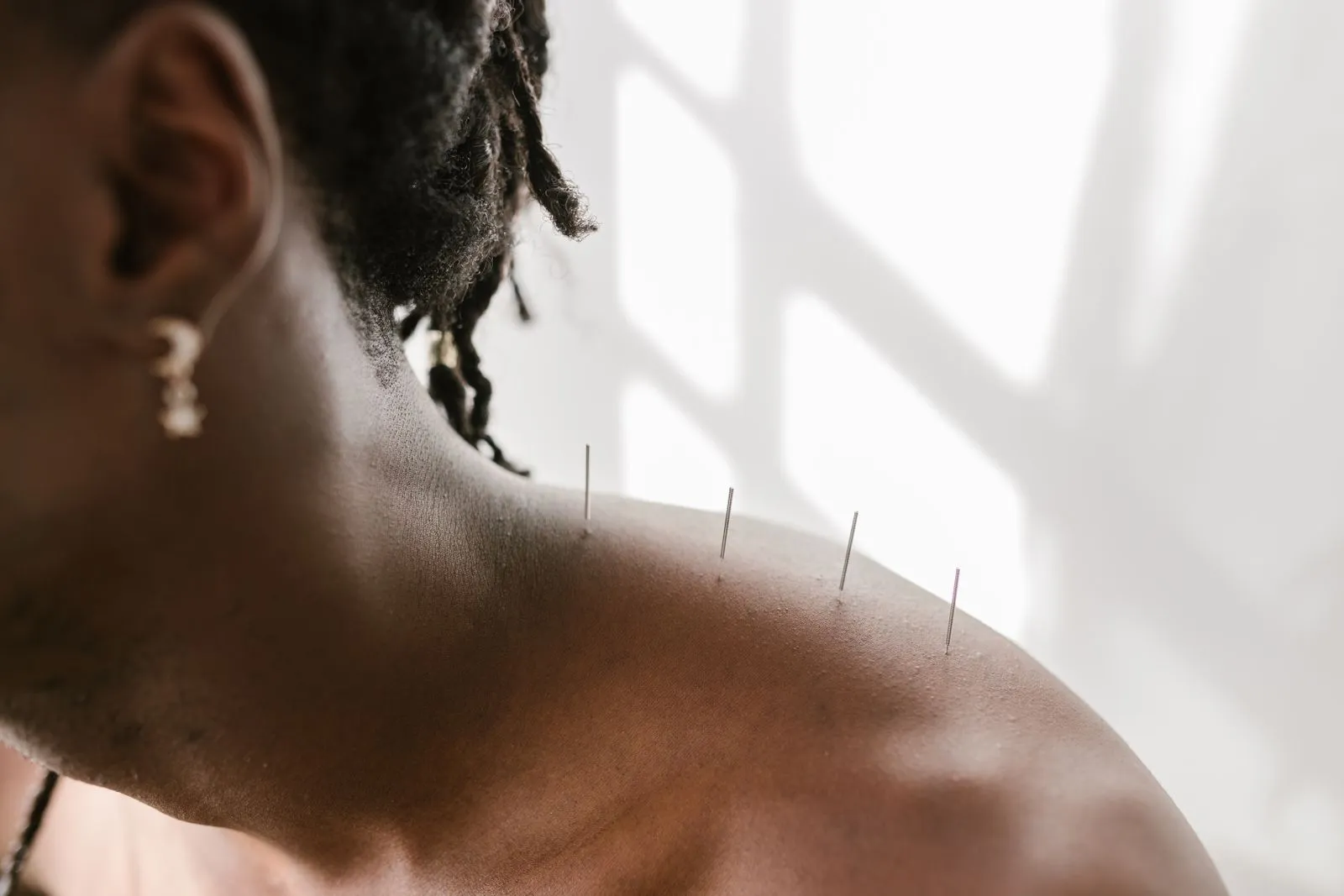 What to Expect at Your First Ear Acupuncture Session
